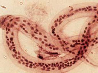 filaryal parazit-92.jpg